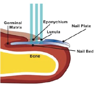 afbeelding nagelplaat